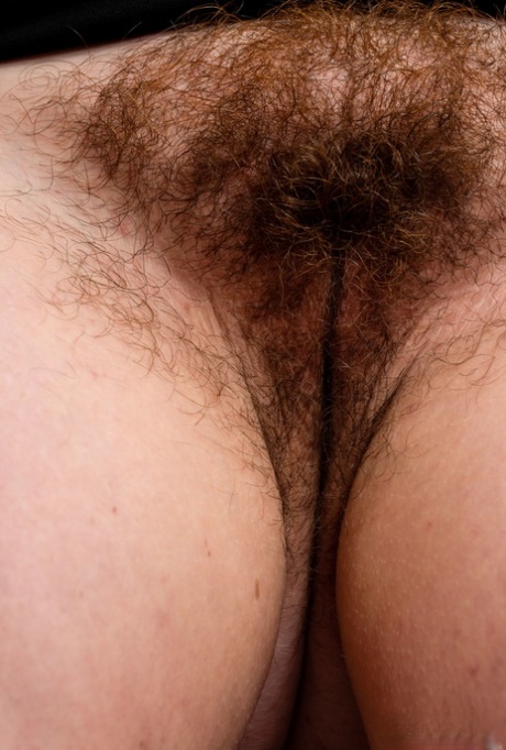 bbw anal prolapse best galleries